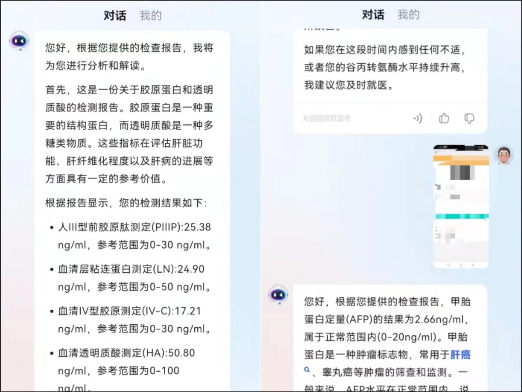 图片[3]-讯飞晓医，最新AI健康助手，你的免费私人医生。 - 87副业网-87副业网